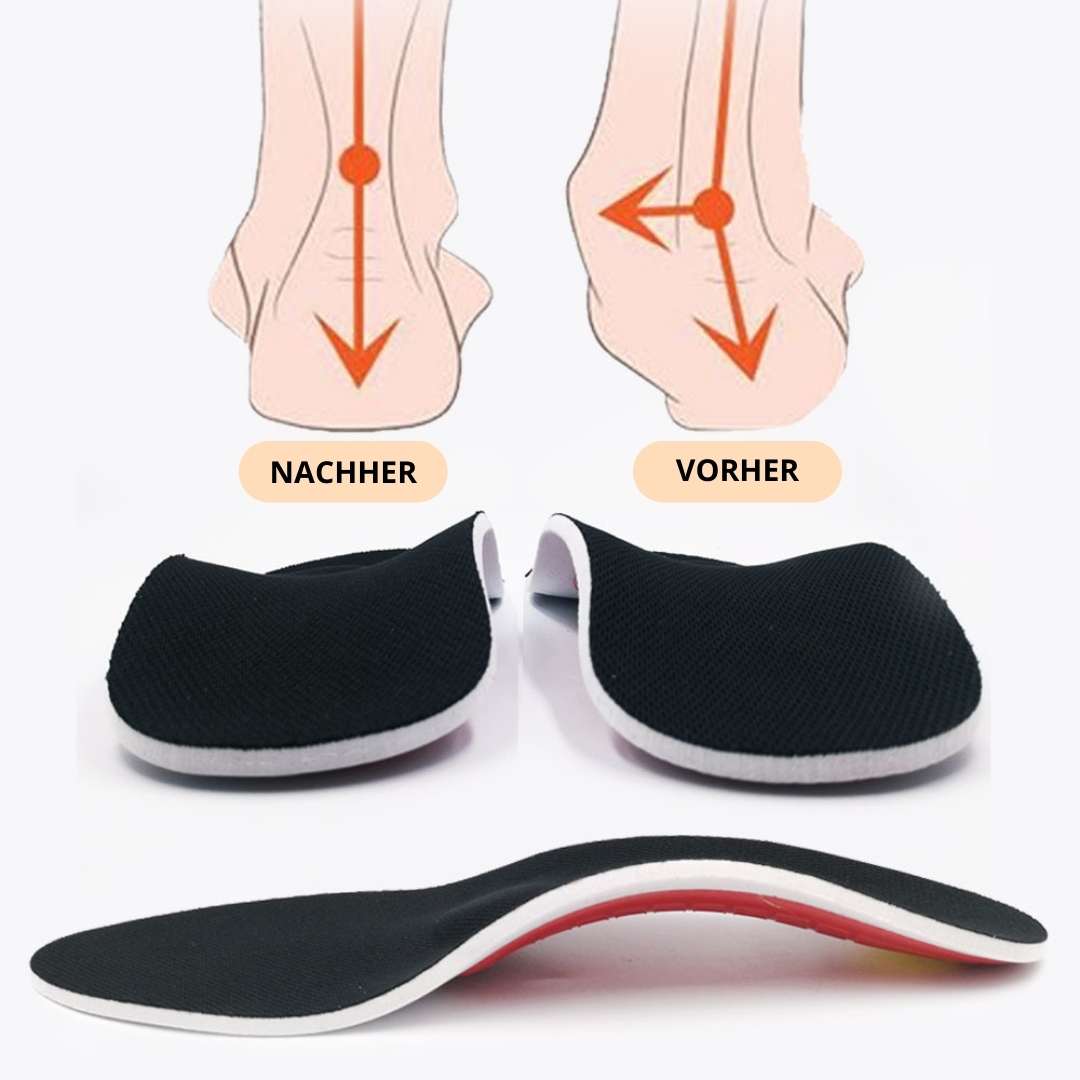 ArchEase™ – Orthopedic Insole with Arch Support for Daily Comfort [1 + 1 Free]