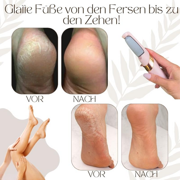 VelvetStep™ — Discover Baby-Soft Feet You'll Be Proud to Show Off