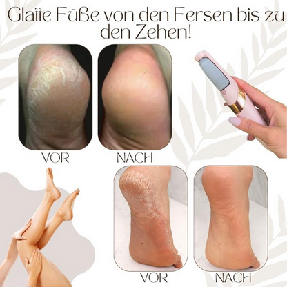 VelvetStep™ — Discover Baby-Soft Feet You'll Be Proud to Show Off