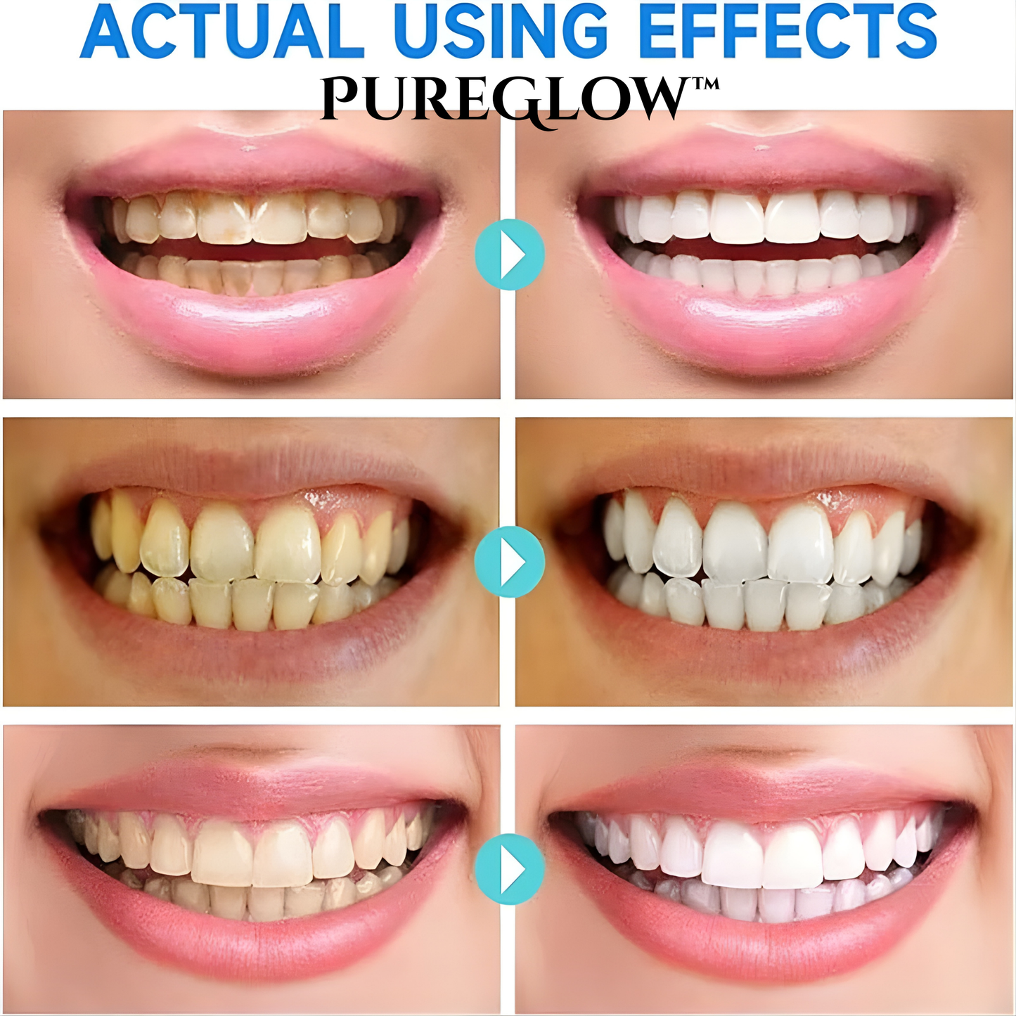 Whitening Toothpaste | Niacinamide Formula | Enamel Repair | Fresh Breath | PureGlow
