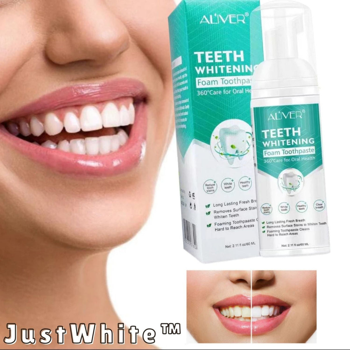 Teeth Whitening Foam Toothpaste – Gentle Stain Removal for Brighter Teeth