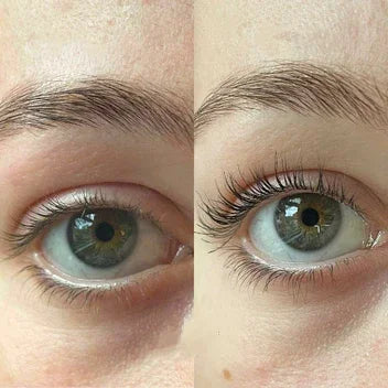 Images™ – Eyelash Growth Serum for Longer, Fuller & Stronger Lashes [50% Off]