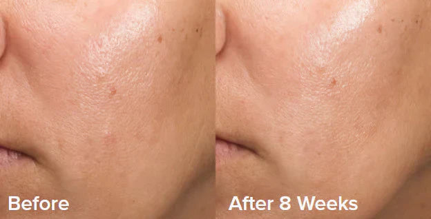 GlowEssence™ – The only peeling gel you need for smooth & radiant skin [50% Off]