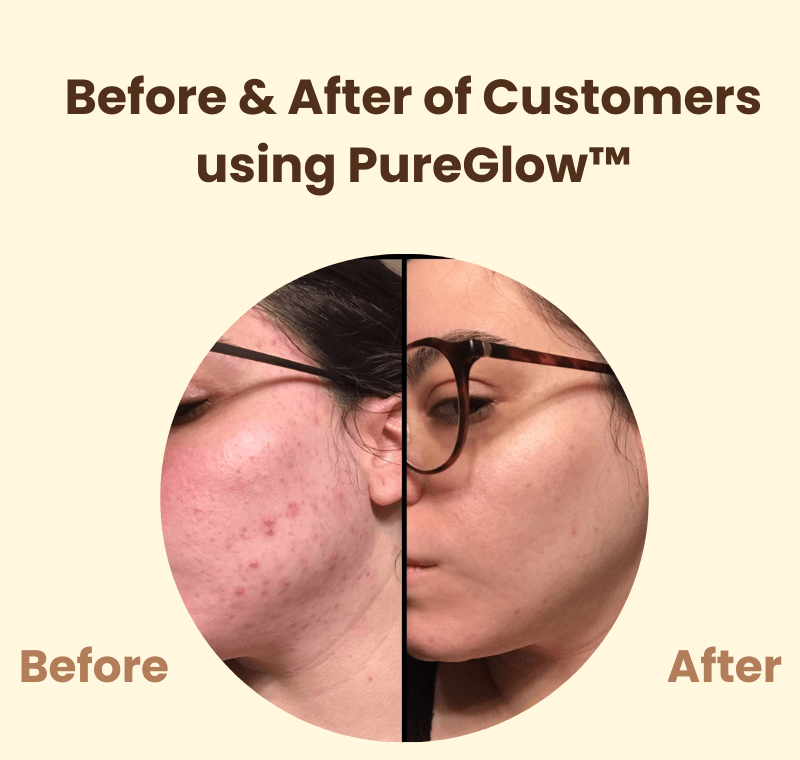 PureGlow™ – Natural Radiance & Renewed, Radiant Self-Confidence [50% Off]