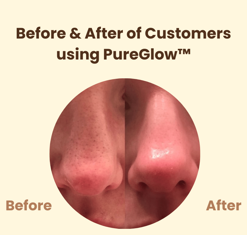 PureGlow™ – Natural Radiance & Renewed, Radiant Self-Confidence [50% Off]