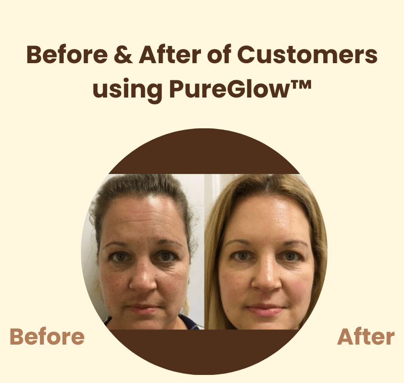PureGlow™ – Natural Radiance & Renewed, Radiant Self-Confidence [50% Off]