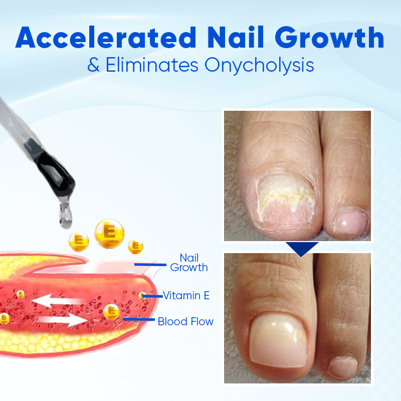 Biancat™ – OnyxoGuard Nail Serum for Moisture & Protection of Brittle Nails [1 + 1 Free]