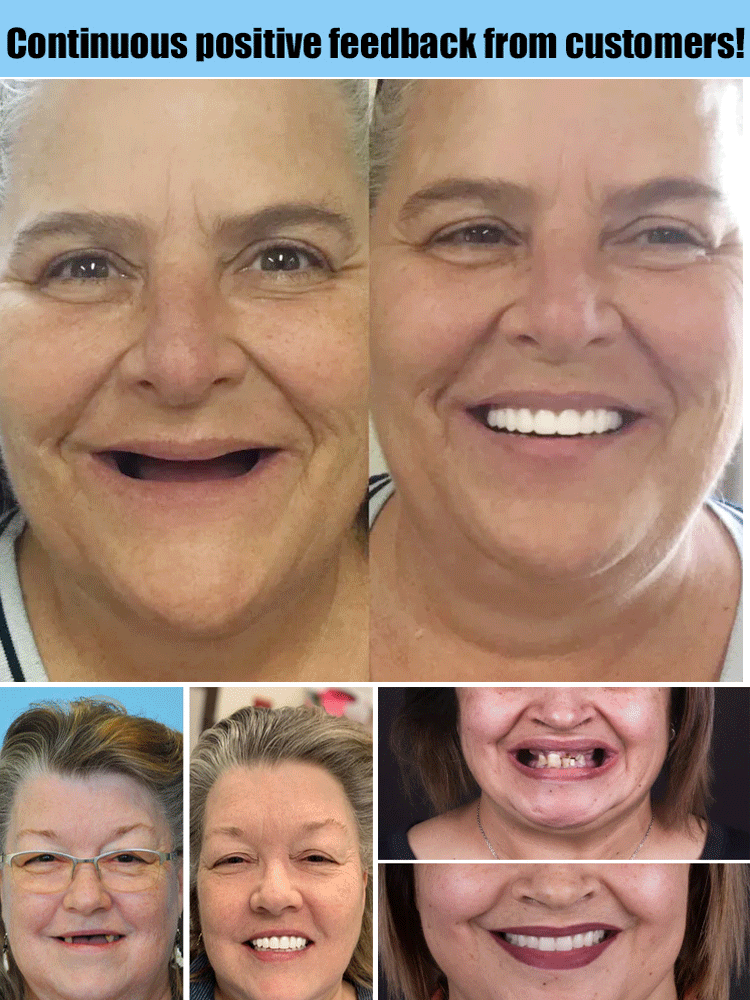 ZahnProtese™  – Natural Smile, Comfortable Fit & Reusable [50% Off]