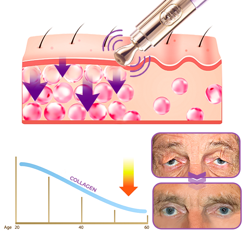 Electric Serum Pen for Skin Tightening with High-Frequency Technology