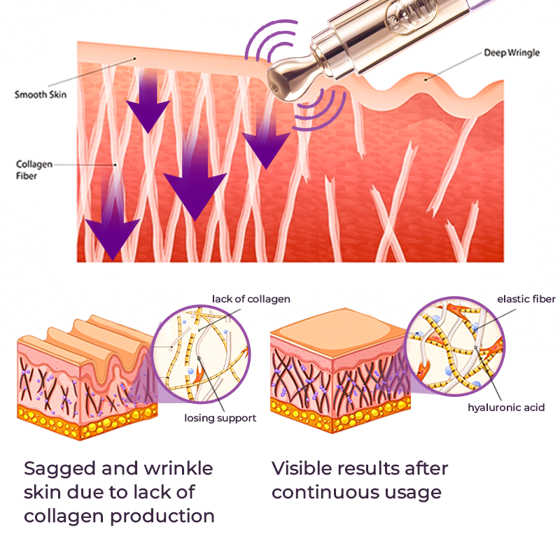 Electric Serum Pen for Skin Tightening with High-Frequency Technology