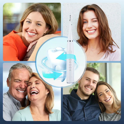 GlanzGebiss – Professional Teeth Cleaning for Radiantly Clean Teeth and Fresh Breath [50% Discount]