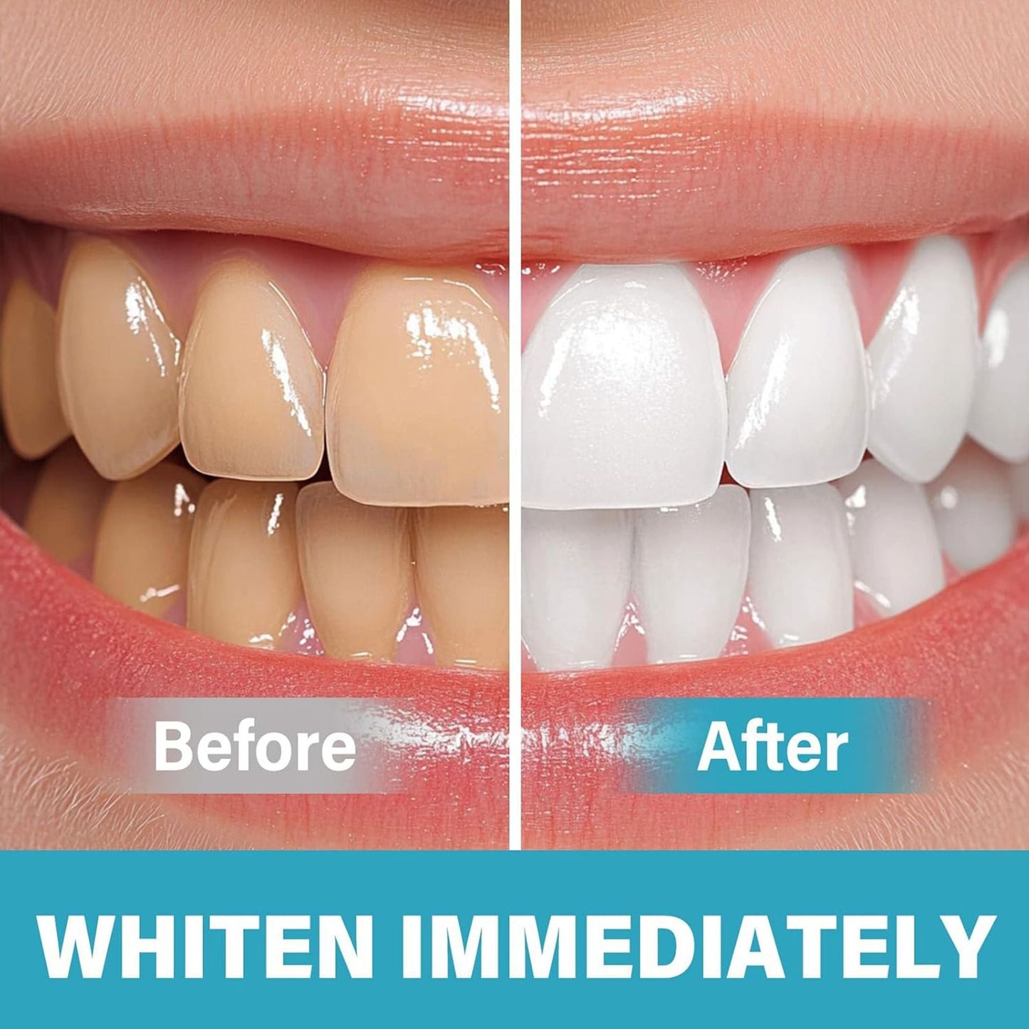 BrightSmile™ – Instant Teeth Whitening Pigment for a Radiant Smile [Buy 1 Get 1 Free]