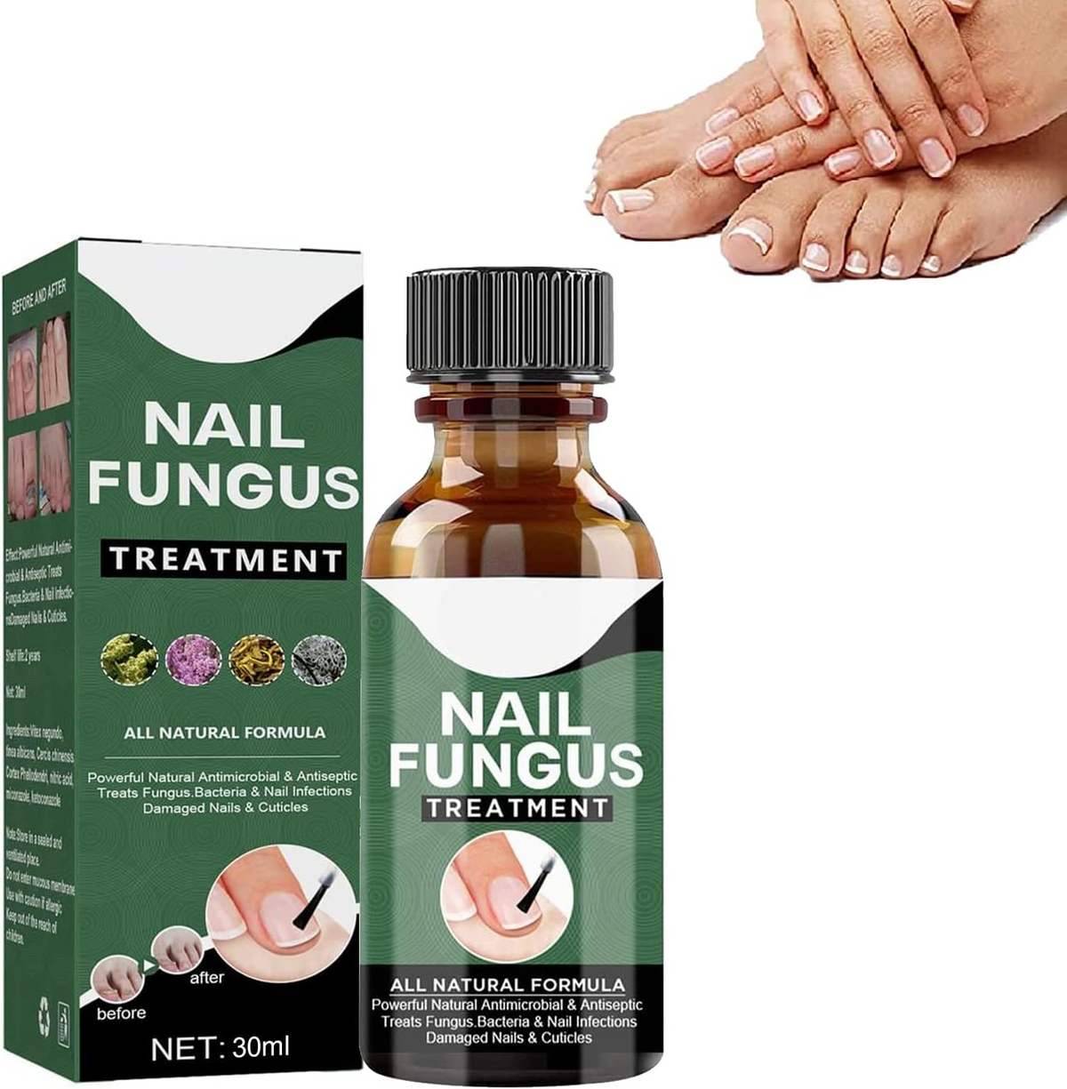 Nail Repair Care Solution for Discolored & Brittle Nails