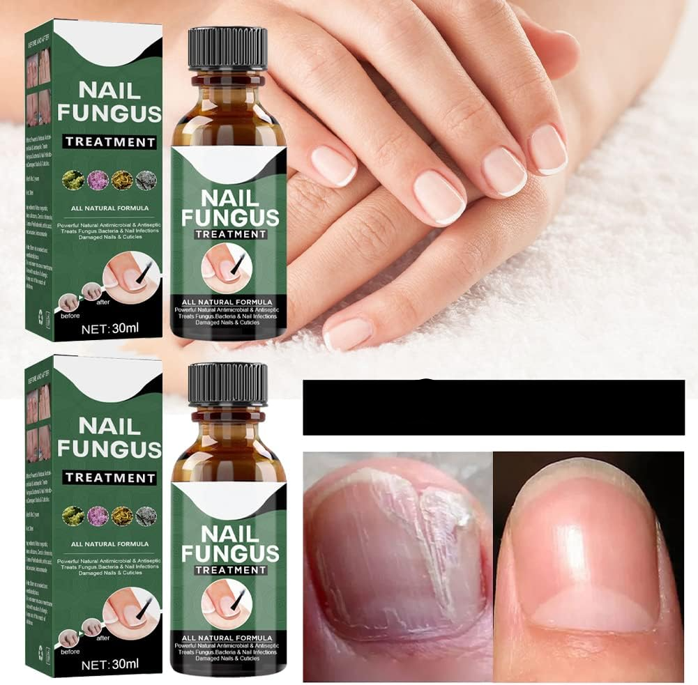 Nail Repair Serum for Discolored & Brittle Nails – Daily Care Formula