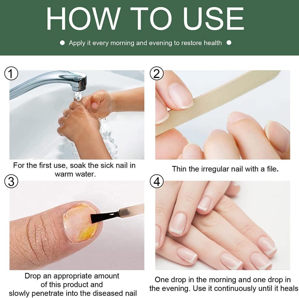 Nail Repair Serum for Discolored & Brittle Nails – Daily Care Formula