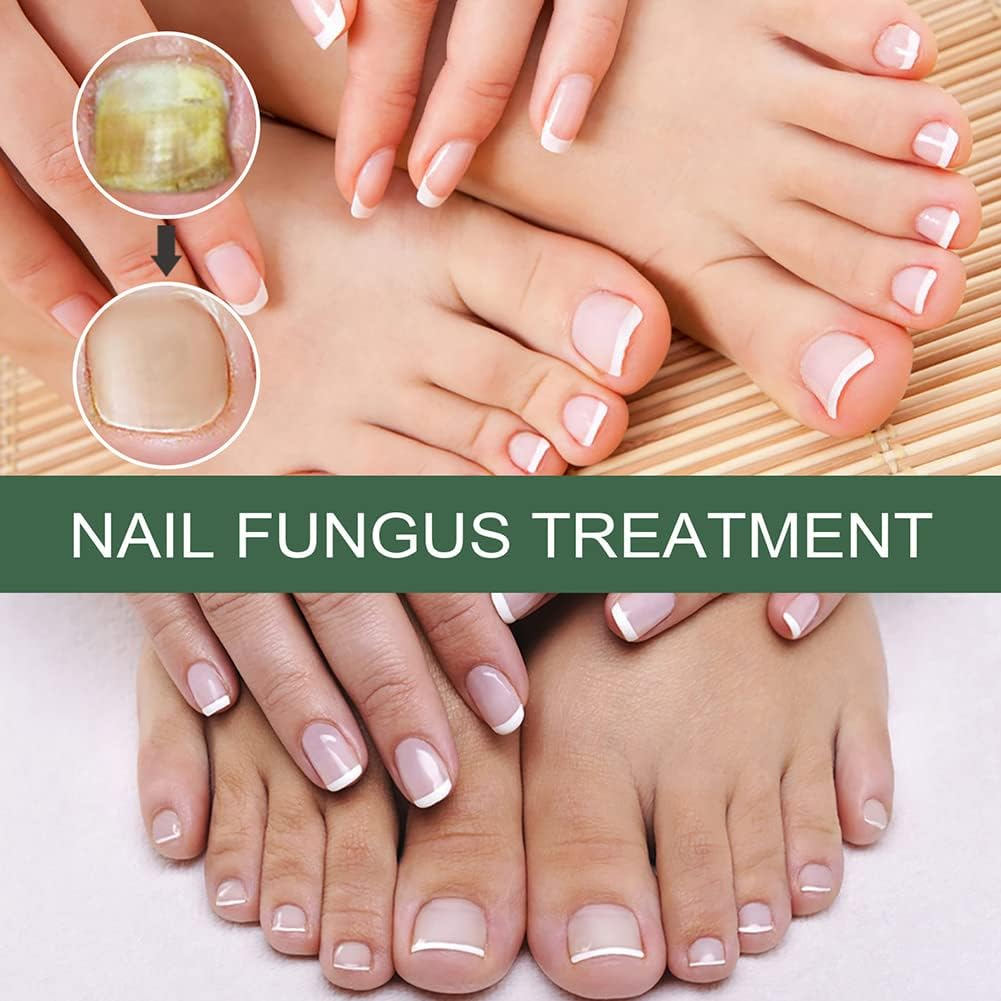 Nail Repair Care Solution for Discolored & Brittle Nails