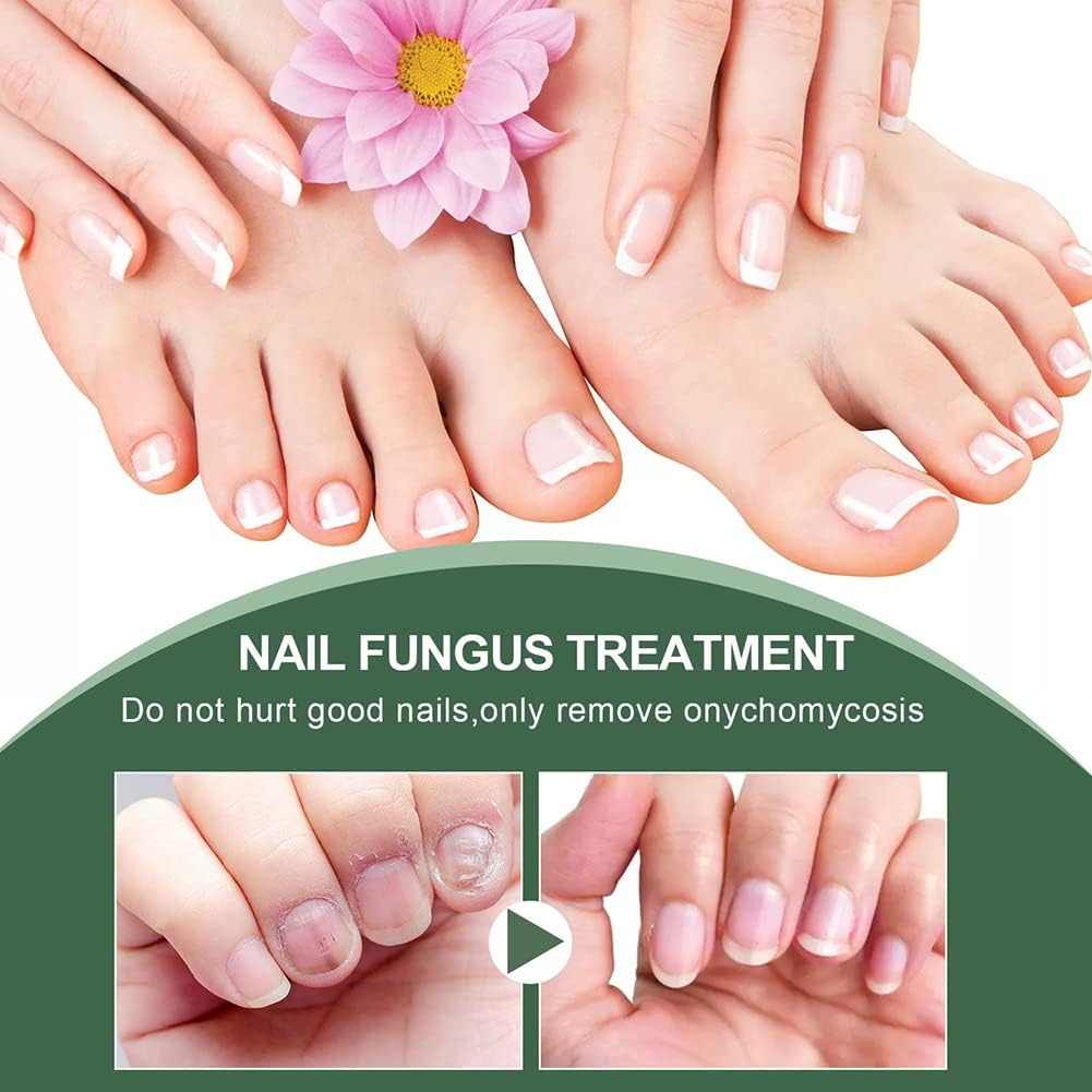 Nail Repair Serum for Discolored & Brittle Nails – Daily Care Formula