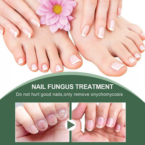 Nail Repair Serum for Discolored & Brittle Nails – Daily Care Formula