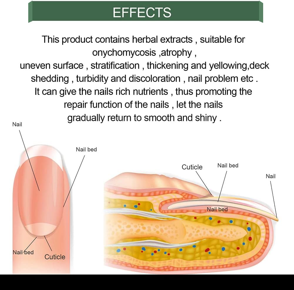 Nail Repair Care Solution for Discolored & Brittle Nails