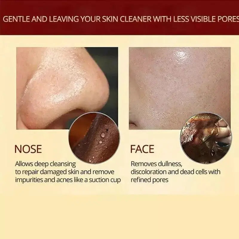HerbalMask™ – Refining Peel-Off Facial Mask: Gentle, Effective, and Soothing [Buy 1 Get 1 Free]