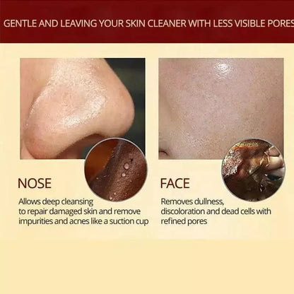 HerbalMask™ – Refining Peel-Off Facial Mask: Gentle, Effective, and Soothing [Buy 1 Get 1 Free]
