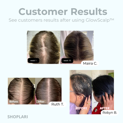 GlowScalp™ – Scalp Massager Brush for Relaxing, Stimulating & Healthy Scalp [50% Off]