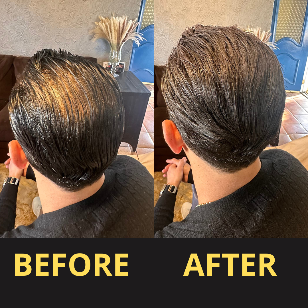 ColorSeal – Hair Thickening Powder for Instantly Fuller Hair [1 + 1 Free]