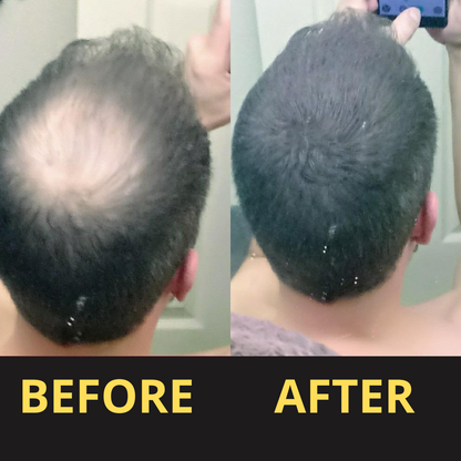 ColorSeal – Hair Thickening Powder for Instantly Fuller Hair [1 + 1 Free]