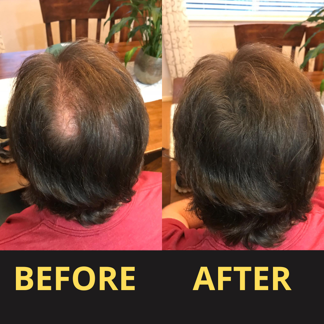 ColorSeal – Hair Thickening Powder for Instantly Fuller Hair [1 + 1 Free]