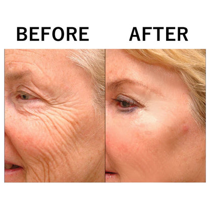 HydraLift – Intensive care for radiant and well-groomed skin with moisture [1 + 1 Free]