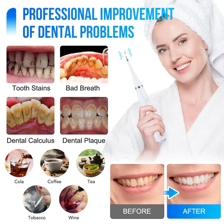 ToothCleaner™ – Effective Care for Radiantly Healthy Teeth! [50% Off]