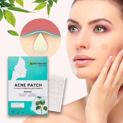 AcNatch – Patches for the Removal of Acne and Skin Imperfections for Clear Skin [50% Discount]