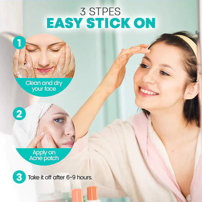 AcNatch – Patches for the Removal of Acne and Skin Imperfections for Clear Skin [50% Discount]