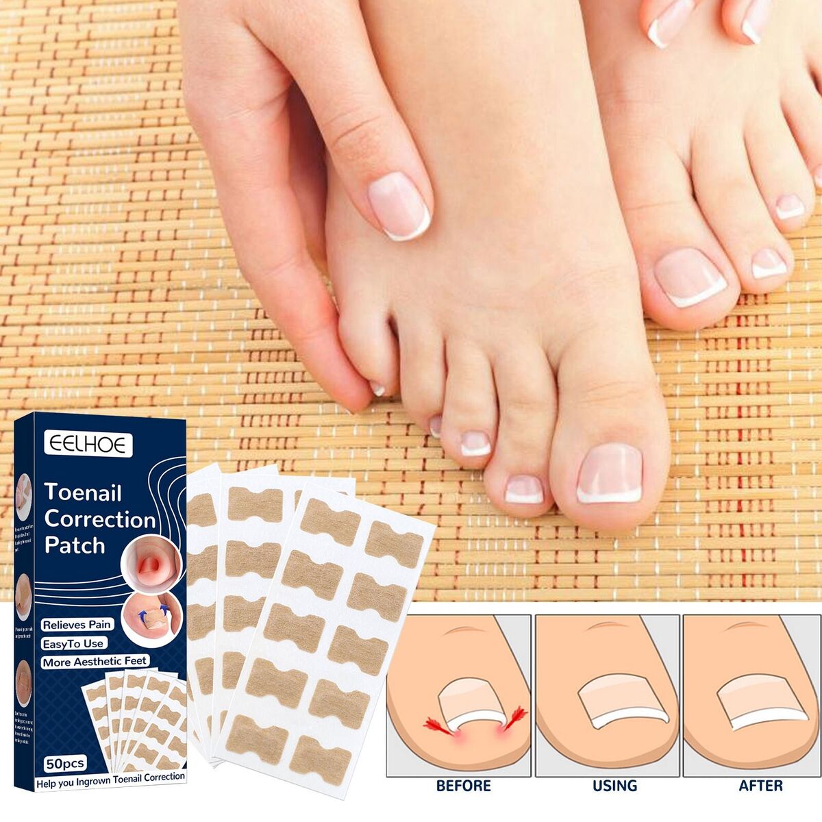 NailLift™ – Correction Pads for Ingrown Toenails: Easy to Use and Protective [Buy 1 Get 1 Free]
