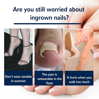 NailLift™ – Correction Pads for Ingrown Toenails: Easy to Use and Protective [Buy 1 Get 1 Free]