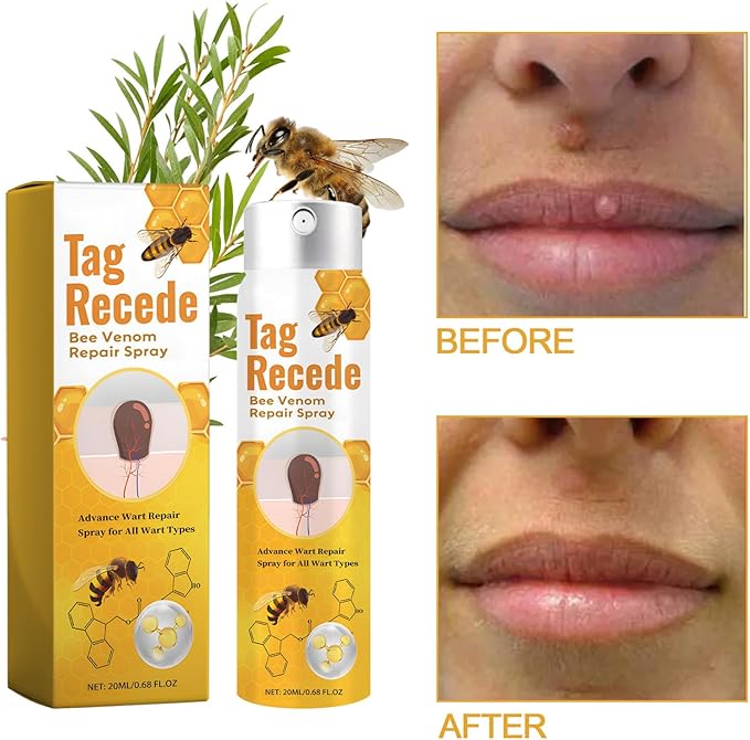Plant-Based Skin Tag & Wart Removal Solution for At-Home Use