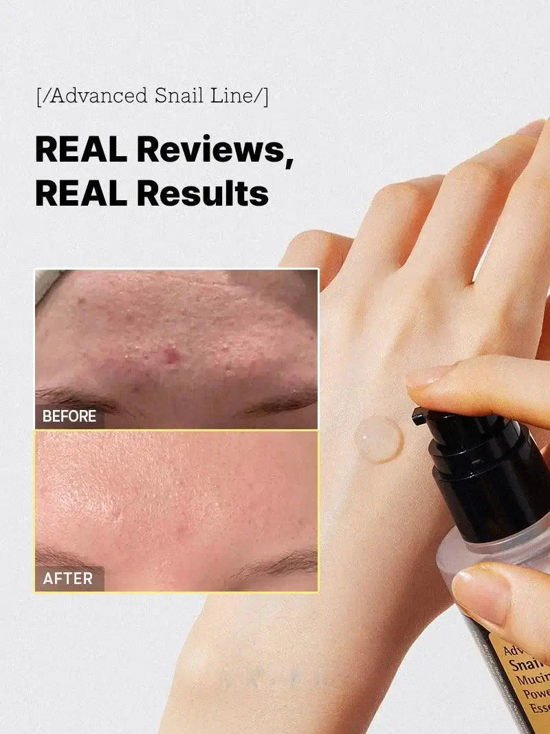 GlowFace™ – 96.3% Snail Mucin, Skin Regeneration & Intensive Hydration [50% Off]