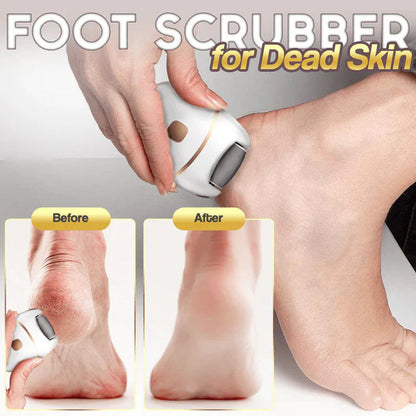 Gleam™ – Gentle Callus Remover for Smooth & Soft Feet [50% Off]