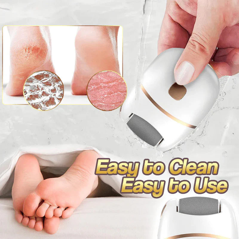 Gleam™ – Gentle Callus Remover for Smooth & Soft Feet [50% Off]