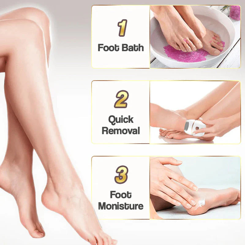 Gleam™ – Gentle Callus Remover for Smooth & Soft Feet [50% Off]