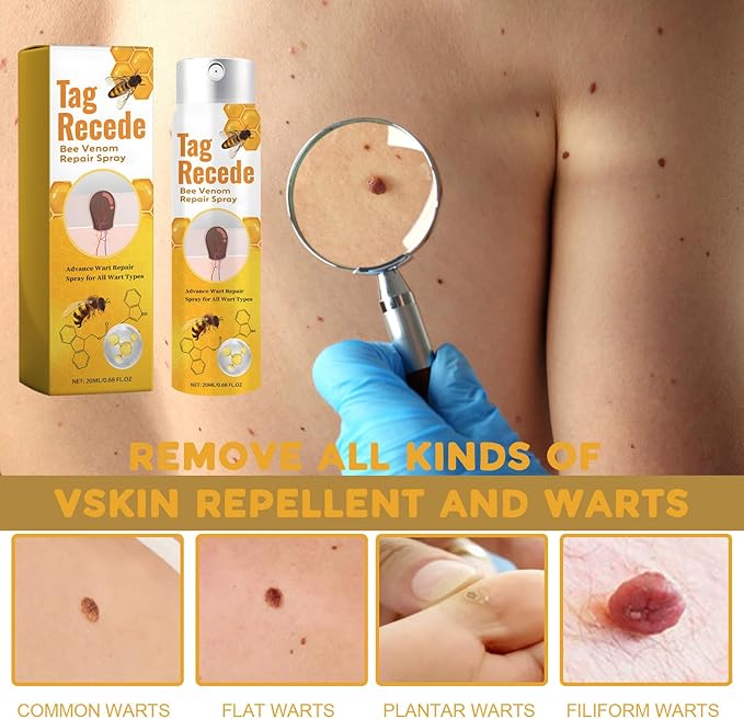 Plant-Based Skin Tag & Wart Removal Solution for At-Home Use