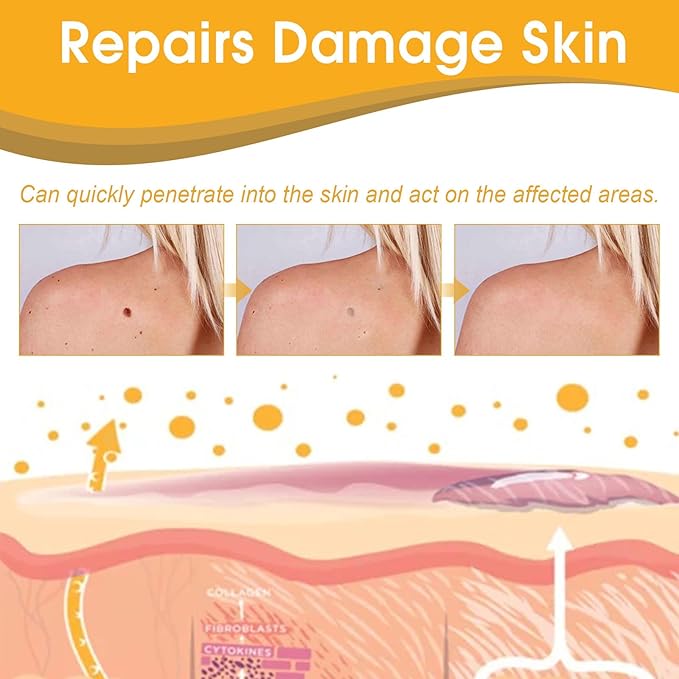 Plant-Based Skin Tag & Wart Removal Solution for At-Home Use