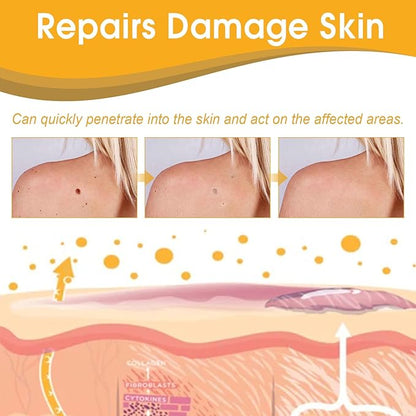 TagAway™ – Effective Removal of Warts and Skin Growths: Fast and Safe [50% Off]