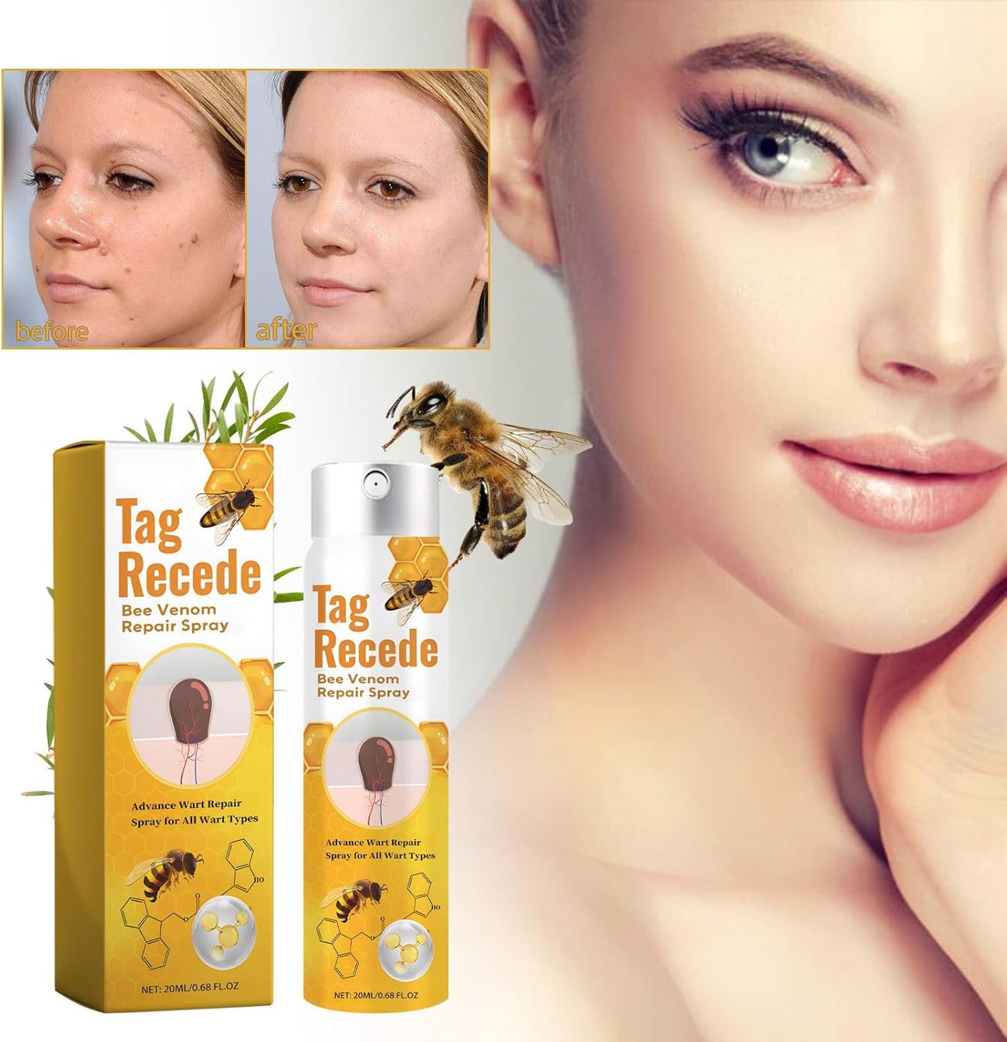 TagAway™ – Effective Removal of Warts and Skin Growths: Fast and Safe [50% Off]