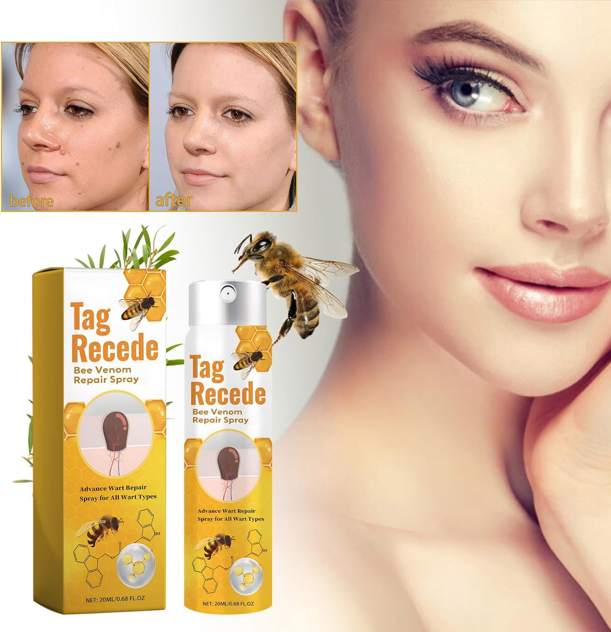 Plant-Based Skin Tag & Wart Removal Solution for At-Home Use