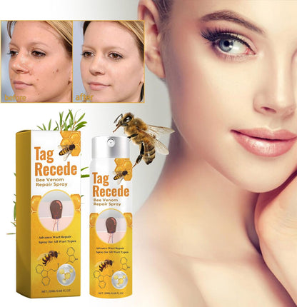 TagAway™ – Effective Removal of Warts and Skin Growths: Fast and Safe [50% Off]