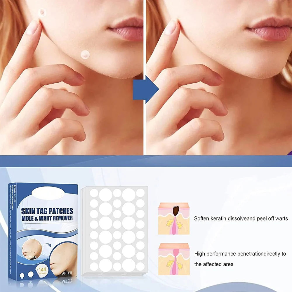 SkinPatch™ – Painless, Non-Invasive Treatment for Visibly Clear, Healthy Skin [1 + 1 Free]