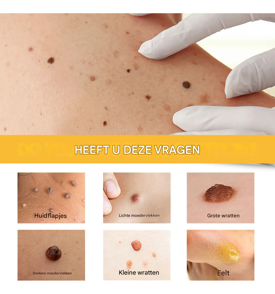 BeeNaturale™ – Gently and Effectively Removes Skin Tags and Blemishes [1 + 1 Free]