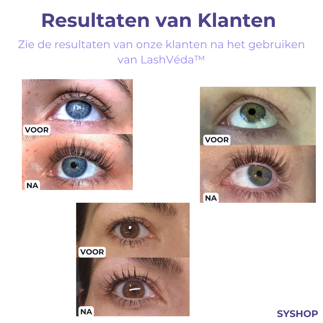 LashVeda™ – Eyelash growth serum for longer, fuller & healthy lashes visible results [1 + 1 Free]